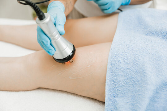 Radio Frequency treatment smoothing and tightening skin on the thighs