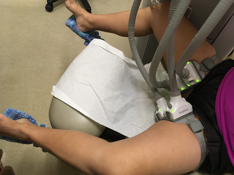 Thigh Slimming Treatment